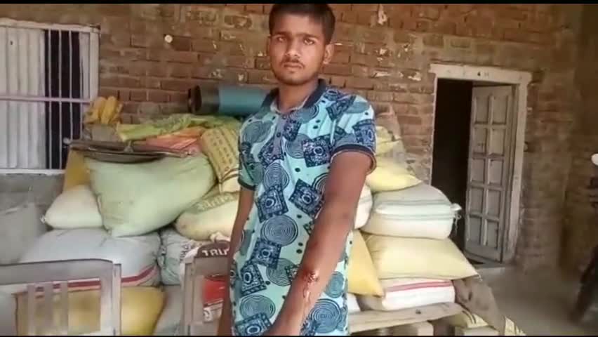 बलरामपुर: ग्राम पंचायत लखनीपुर में तेंदुए ने खेतों में काम कर रहे चार लोगों को हमलाकर किया घायल #तेंदुआ