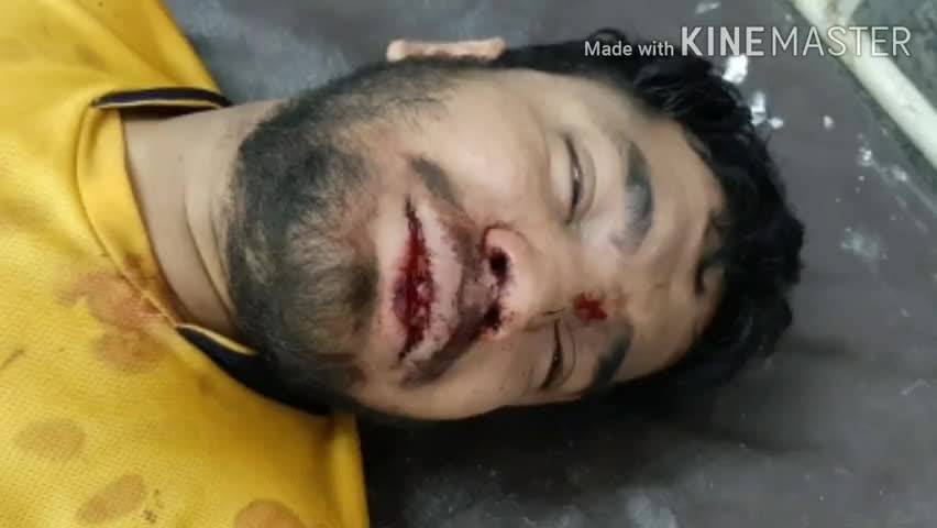 बिलासपुर: प्रेस फोटोग्राफर के पुत्र पर असामाज़िक तत्वों ने किया जानलेवा हमला, आरोपी गिरफ्तार #अपराध #जानलेवा_हमला