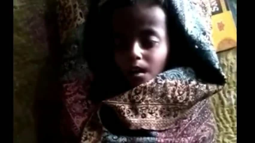 किस्को: अरेया गांव के 4 वर्षीय कुपोषित बच्ची की सदर अस्पताल में इलाज के दौरान हुई मौत #मौत #कुपोषण
