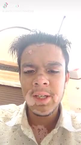 कपासन: is ladke ko mili dhamki kripya iski shayta kare nam rahul sukhwal bhanoda mohhla jald se jald sahayta kre #kapasan