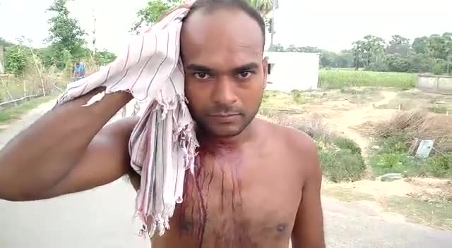 गया टाउन सीडी ब्लॉक: जमीनी विवाद को लेकर दो भाइयों में हुई मारपीट #बांके बाजार