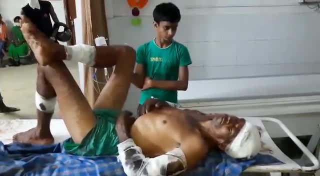 जयनगर: #जमीनी विवाद में हिंसक झड़प ,अस्पताल में इलाजरत