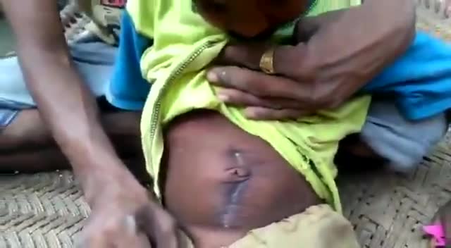 धन्यवाद #सोनू_सूद।
 आपकी मदद से #ग़रीब_परिवार_के_चिराग 
#करन की
#हँसी_लौटी।