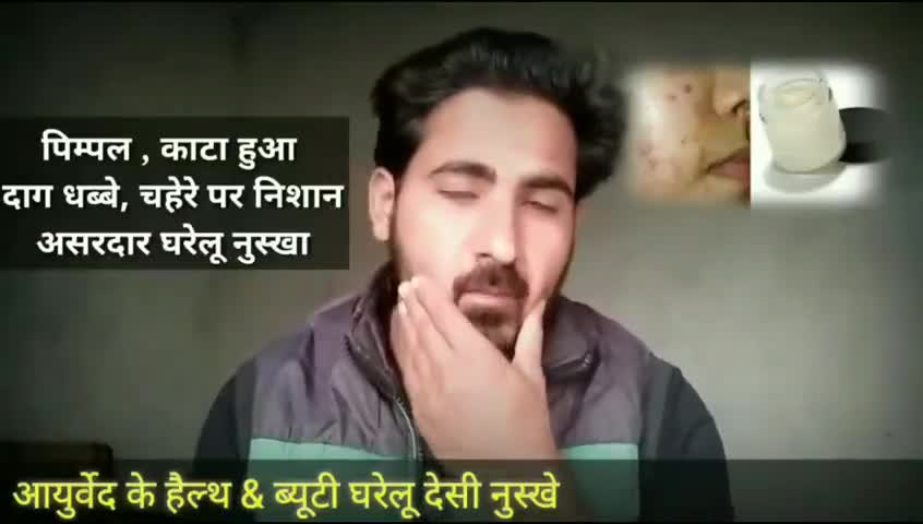 मोदीनगर: gharelu pimples ka elaj kare #pimples #ayurvedic #nuskhe