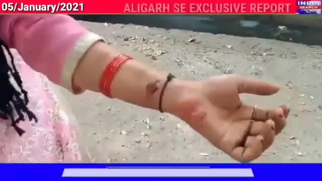 कोल: Aligarh नगला पटवारी में दहेज के लिए ससुराल वालों ने महिला को दी दर्दनाक की यातनाएं।
#indiasearchnews #shahidraza