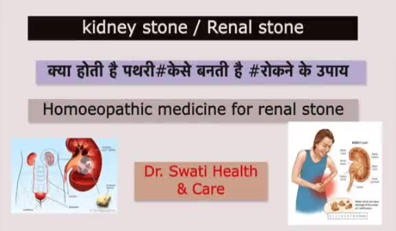 #सेहत
पथरी की समस्या और उपचार
#drswati Vyash
प्रशान्त होमेओपथिक अरोग्यालय वारासिवनी
https://youtu.be/045LA-kR4iE
