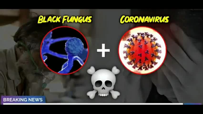 कोरोना के बाद एक और महामारी | राजस्थान मे ब्लैक फंगस महामारी घोषित #कोरोना #blackfungus #lockdown #narukaneeraj1