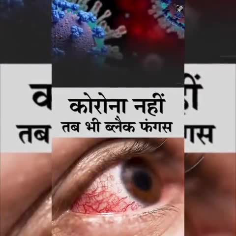 #जानकारी: क्या #कोविड-19 इन्फेक्शन के बिना भी #blackfungus हो सकता है? #ब्लैक_फंगस का कारण सिर्फ इंडस्ट्रियल ऑक्सीजन है?