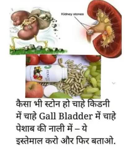 पिते और गुरदे पथरी का जड़ से इलाज।    Renatus nova#600+बीमारियों का  एक ही इलाज। results 100%
ph.8814915740