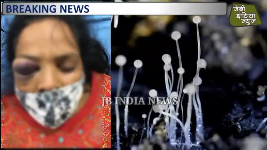 महू में ब्लेक फंगस से यह दूसरी मौत है पहले कोदरिया निवासी व्यक्ति की हुयी थी
।।राजीव मेहरा।। #Bleckfungas #covide19