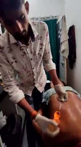 आयुर्वेद मे #कमर_दर्द _घुटने_दर्द_सियाटिका_स्लिप_डिस्क का ईलाज    Fire cupping therapy  से।। पता पण्डेर wht. 9982437471