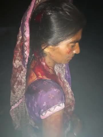 निर्मला ,पति का नाम जयवीर #थाना #सकीट गांव #शेखपुरा आज गांव के ही 8-10 लोगों ने घेर कर इनकी लड़कियों पर वार किया इनको घायल कर दिया सभी लोग एटा अस्पताल में भर्ती
 #निर्मला की हालत #सीरियस है  इनकी #लड़कियों को भी गम्भीर चोटे लगी हुई है  एटा