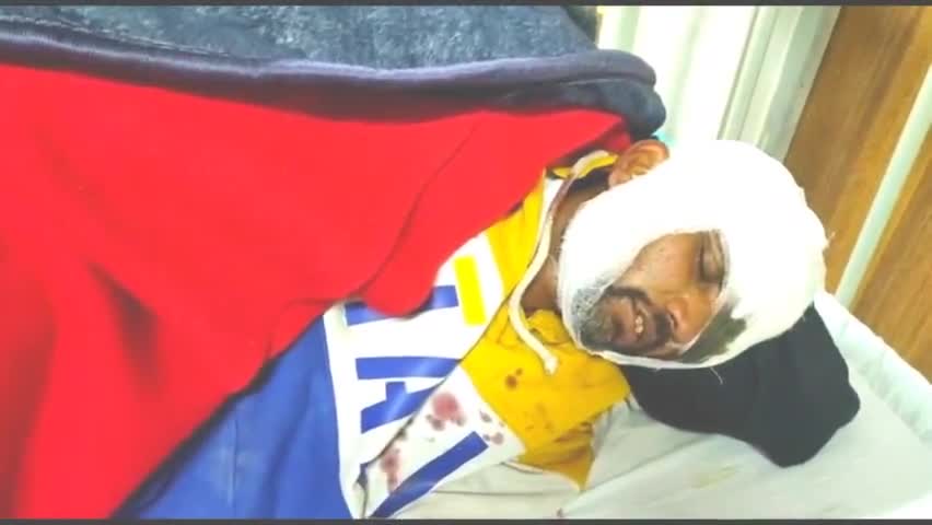 देेेवरिया: #कोटवा मोड़ के समीप में तेज रफ्तार में जा रही चार पहिया वाहन ने एक युवक को मारी टक्कर गंभीर रूप से घायल