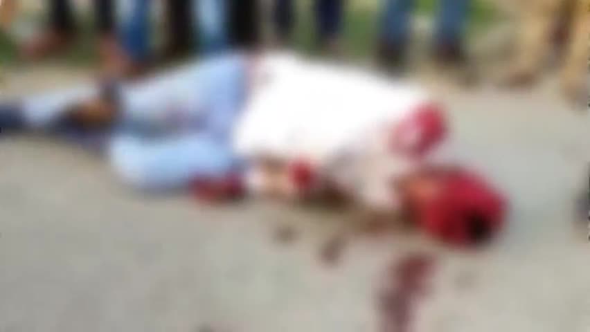 देेेवरिया: #नई बाजार के समीप में तेज रफ्तार में आ रही ट्रक की चपेट में आने से बाइक सवार गंभीर रूप से घायल