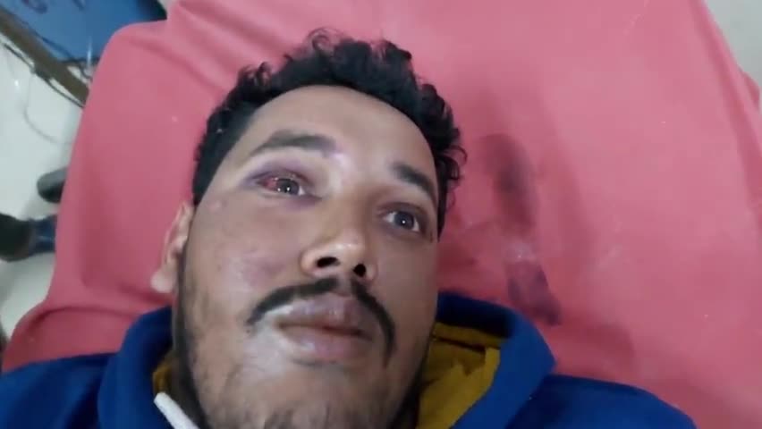 गोविंदपुर: ईस्ट इंडिया मोड़ पर पुलिस द्वारा की गई कथित पिटाई से परासी के एक छात्र की हालत गंभीर, SNMMCH धनबाद में भर्ती #दहशत