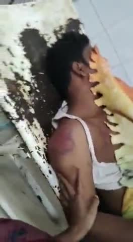 भागलपुर जगदीशपुर के सलेमपुर में किसान को गोली मारकर बदमाशों ने किया घायल एवं लूट####crimenal