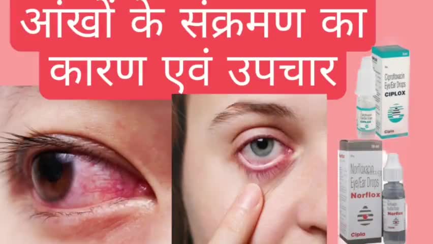 आंखों में इन्फेक्शन को दूर करने वाले medicine/ subscribe my youtube channel ;- tecpharmacy #healthtips #medicine
