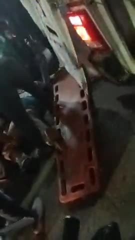 गोरखपुर: बड़ी ख़बर सीएम सिटी गोरखपुर के आर्य नगर से अज्ञात वाहन ने मारी ठोकर आई गंभीर चोट देखिए वीडियो में #cmCity  #gorakhpur