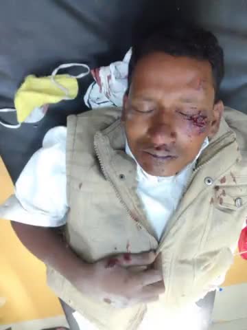 महोबा: शंकर कुशवाहा( प्रभारी BMP) अर्तरा जा रहे थे तो रस्ते में हुई सड़क दुघर्टना #mohdsarfaraj1 #mahobanews