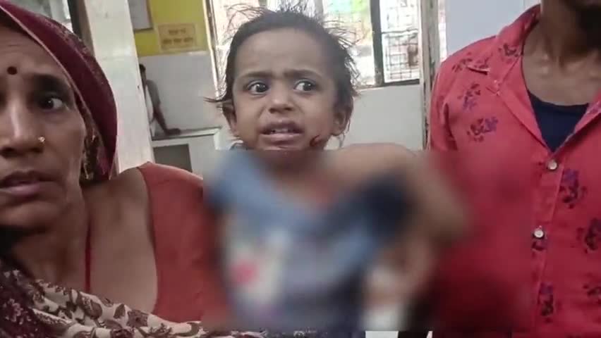 इकौना: मिर्चिहा में मासूम बच्ची पर सियार ने बोला हमला, मासूम हुई लहूलुहान #सियार