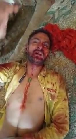 तिगरी के शाहपुर में आपसी रंजिश के चलते फावड़े से किया हमला हालत गंभीर किया रेफर #jeevika