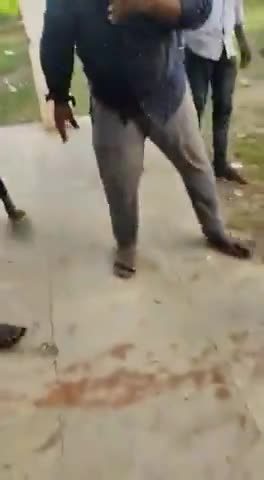 A man from #Karnataka's Shivamogga was bitten by the Cobra  when he tried to kiss it. He survived the snakebite#hdnews