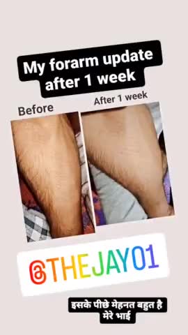forarm update #thejay #thejay01