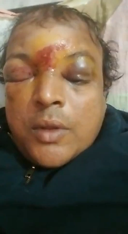 बिहार के बाँका में इंटर के परिक्षार्थियों ने डिस्ट्रिक्ट मज़िस्ट्रेट का ये हाल कर दिया, परीक्षाकाल में चीटिंग रोकने हेतु की थी कोशिश…।


 #बिहार #Bihar #बाँका