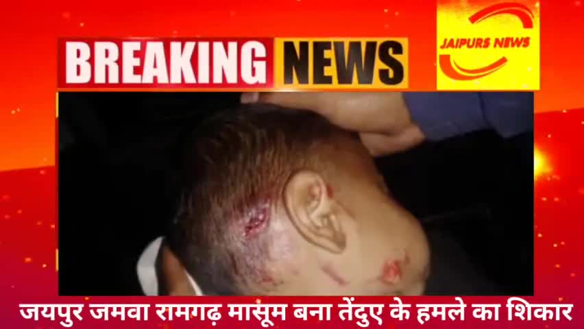 जयपुर जामवा रामगढ़ मासूम बना तेंदुए के हमले का शिकार #news #jaipurs #jaipursnews #जयपुर #wildlife