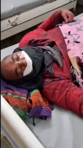 भोरे मे दो मोटरसाइकिल सवार के बीच हुई जोरदार टक्कर में एक की मौत, दूसरा बुरी तरह जख़्मी. 
#gopalganj #kuchaikote #bhore