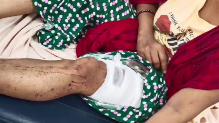 बालसमंद: मुलतानी चौक के पास #मामी पर हमला करने वाले #भांजे नवीन पर मामला दर्ज,बर्फ तोड़ने वाले #सूए से किए थे वार