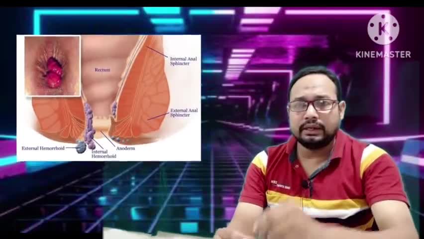 what is hemorrhoids cause sign and symptom #gharelunuskhe #healthnew