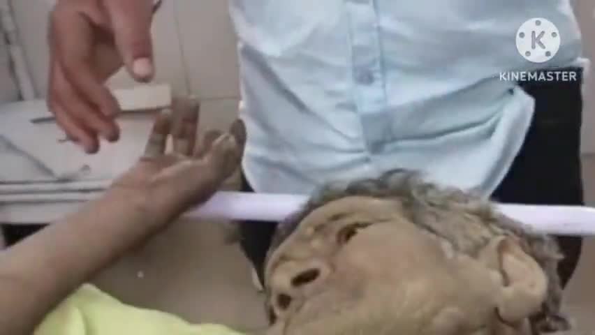 बास: गांव मुंढाल के पास अनियंत्रित होकर कार खाई में गिरी, हादसे में 3 लोगों की हुई मौत