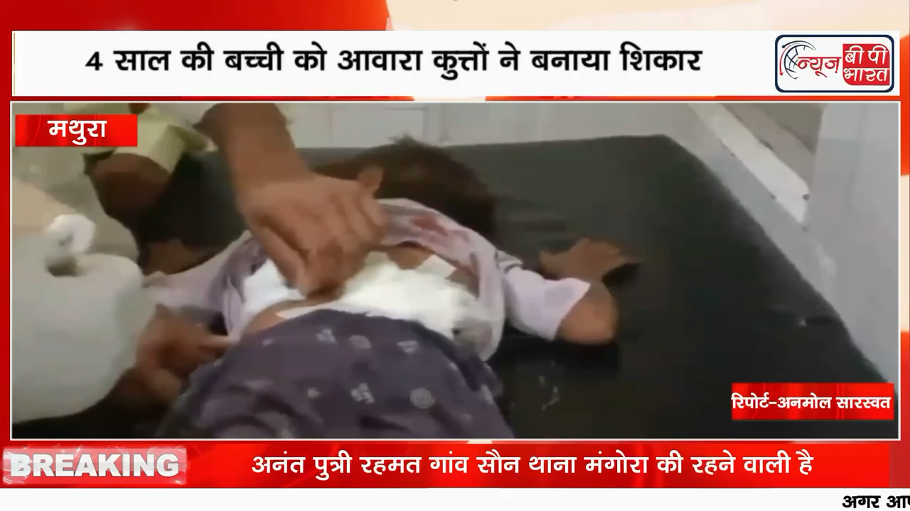 मथुरा: मथुरा : 4 वर्षीय मासूम को गांव सौन में आवारा कुत्त्तों ने बनाया शिकार #Mathuranews #viralreels