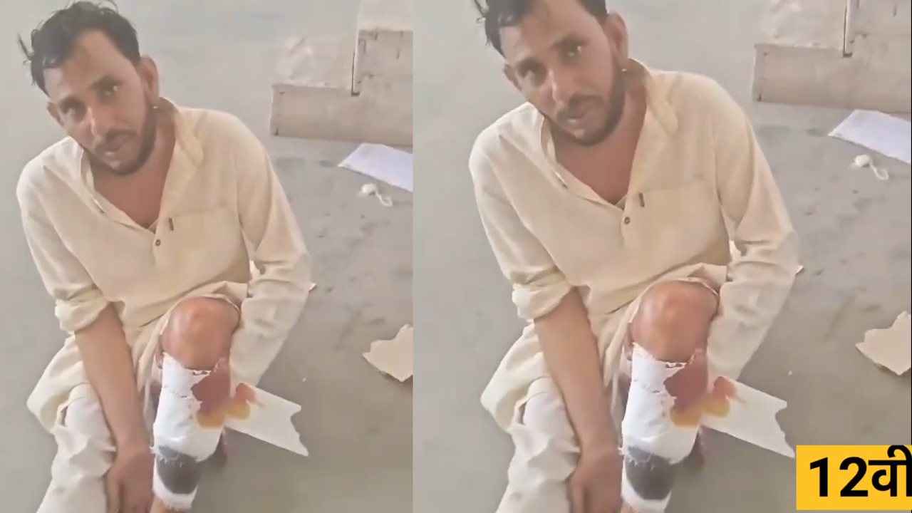 पुलिस पीछे भागी तो गौ तस्कर का पत्थरों पर गिरा पैर टूटा थाने में लगड़ाते हुए चला दूसरों को नसीयत दी... #पहाड़ीथाना #गौ_तस्कर #news