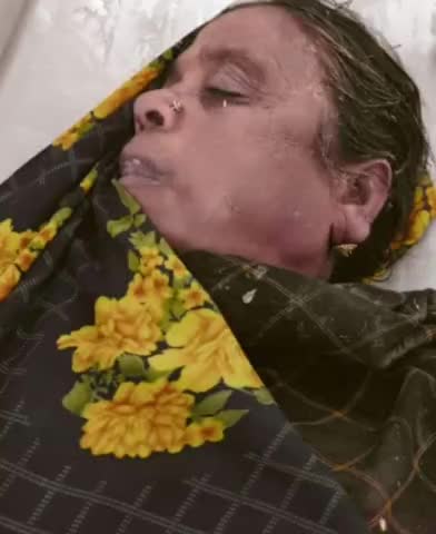 जामू पंचायत में रहने वाले एक महिला की वर्जपत  से मौत
