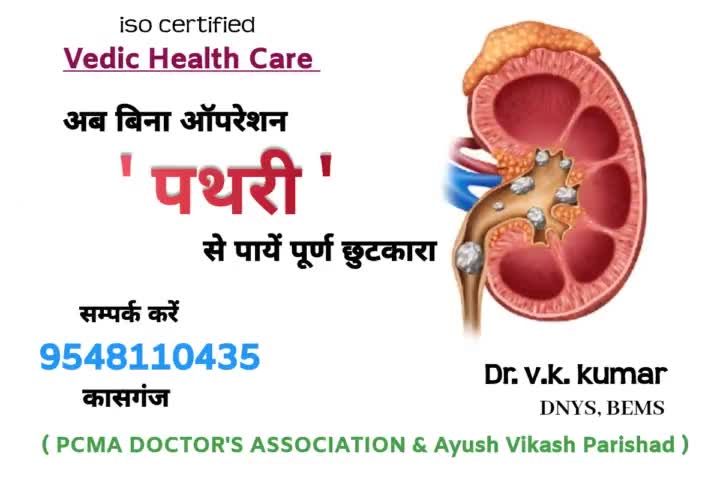 पथरी
#kasganj #kasganjnews #कासगंज #health #viral #up87 #kasganjcity #patiyali #myasur #news
