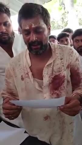 बनारस वाले मिश्रा जी के नाम से प्रसिद्ध हरीश मिश्रा ने आज दिन शनिवार को अपने ऊपर हुए हमले के सम्बन्ध में प्रेसवार्ता।
#banaras #highlight #exploremore #news #mishraji