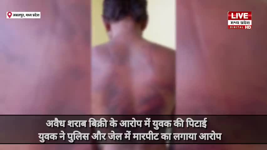 Jabalpur News: अवैध #शराब बिक्री के आरोप में युवक की #पिटाई। युवक ने #पुलिस और #जेल में #मारपीट का लगाया आरोप......