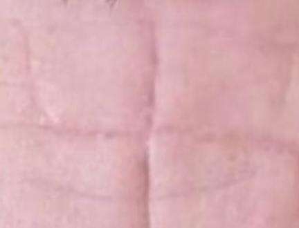 यूक्रेन के बंदी बनाए गए सैनिकों के माथे पर रूसी सैनिकों ने चाकू से बनाए नाज़ी चिह्न, तस्वीरें आईं सामने #यूक्रेन_संकट