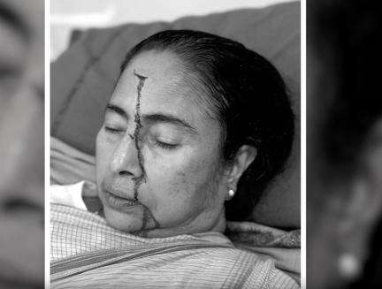ममता बनर्जी अपने ड्रॉइंग रूम में टहलने के दौरान फिसलकर गिर गई थीं: टीएमसी नेता #ममता_बनर्जी