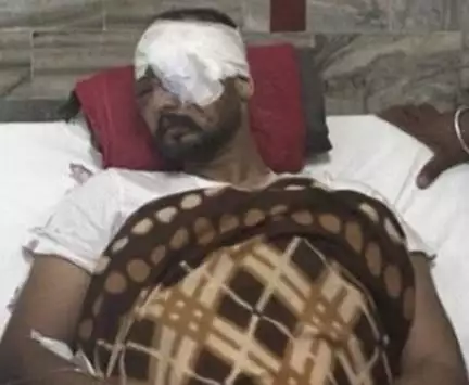 किसानों पर पैलेट गन चलाई गई, कम से कम 3 किसानों की आंखों की रोशनी गई: पंजाब के स्वास्थ्य मंत्री #किसान_आंदोलन