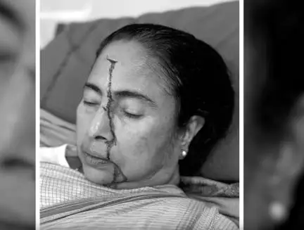 ममता बनर्जी अपने ड्रॉइंग रूम में टहलने के दौरान फिसलकर गिर गई थीं: टीएमसी नेता #ममता_बनर्जी